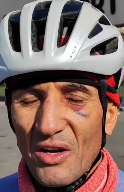 حمله به ملی پوش دوچرخه سواری ایران با پنجه بوکس